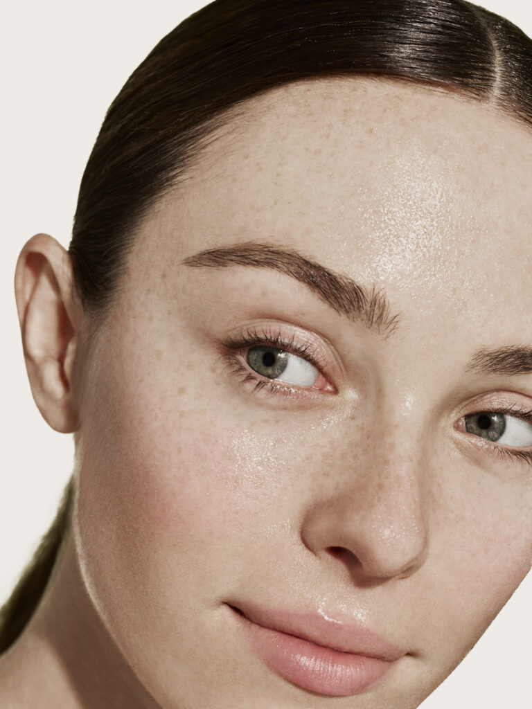 How To Fade Dark Spots In 10 Days Skindays How To Fade Dark Spots In 10 Days Skindays